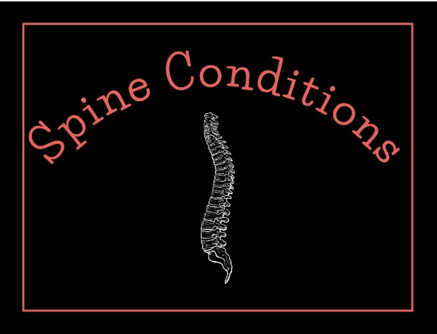 picture of a spine labelled spine conditions
